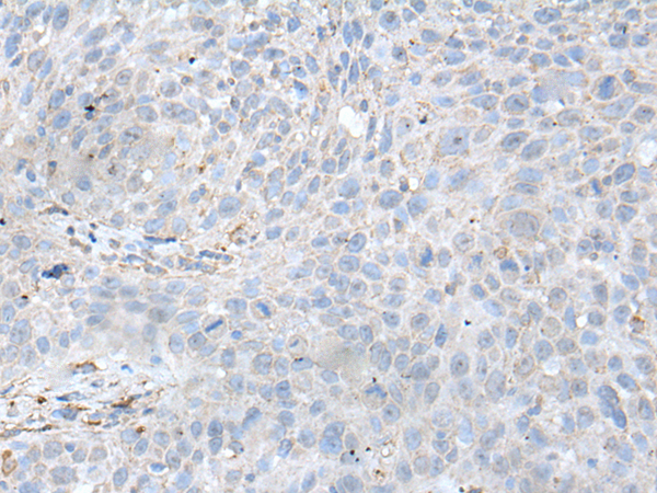 Rabbit Polyclonal Antibody to UBE2W