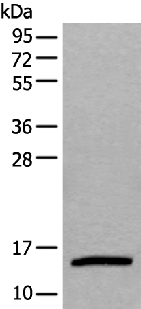 Rabbit Polyclonal Antibody to UBE2D3