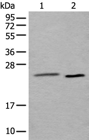 Rabbit Polyclonal Antibody to UBE2T