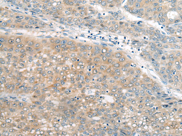 Rabbit Polyclonal Antibody to UBE2G2