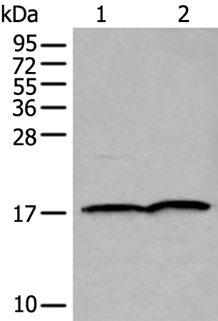 Rabbit Polyclonal Antibody to UBE2V2