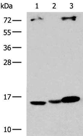 Rabbit Polyclonal Antibody to UBE2D1
