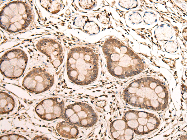 Rabbit Polyclonal Antibody to UBE2M