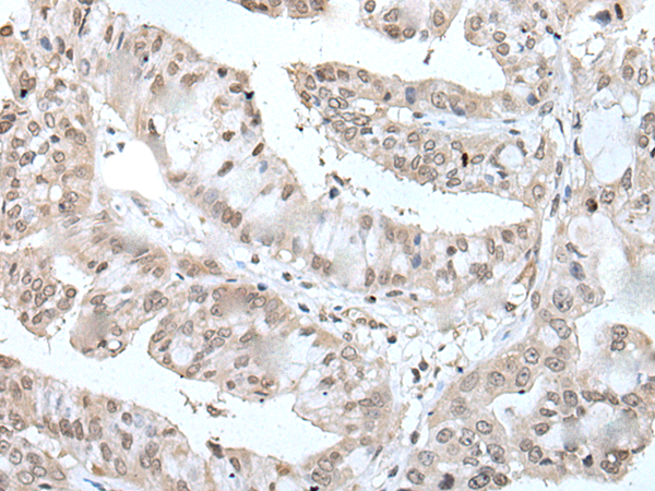 Rabbit Polyclonal Antibody to UBE2E2