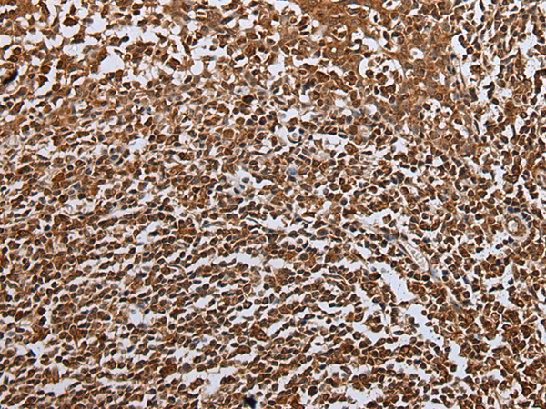Rabbit Polyclonal Antibody to UBE4A