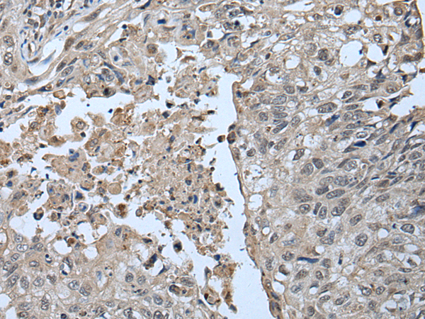 Rabbit Polyclonal Antibody to UBR2