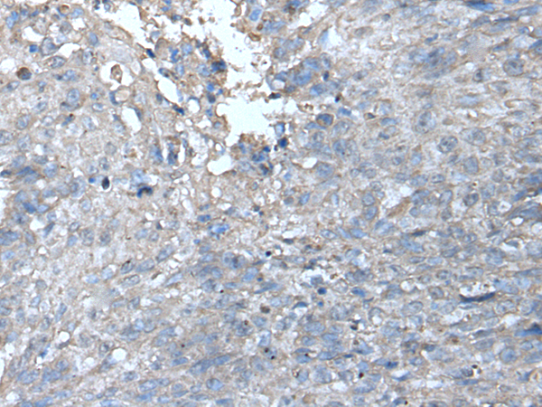 Rabbit Polyclonal Antibody to UFC1
