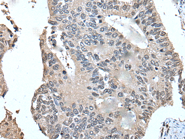 Rabbit Polyclonal Antibody to UFM1