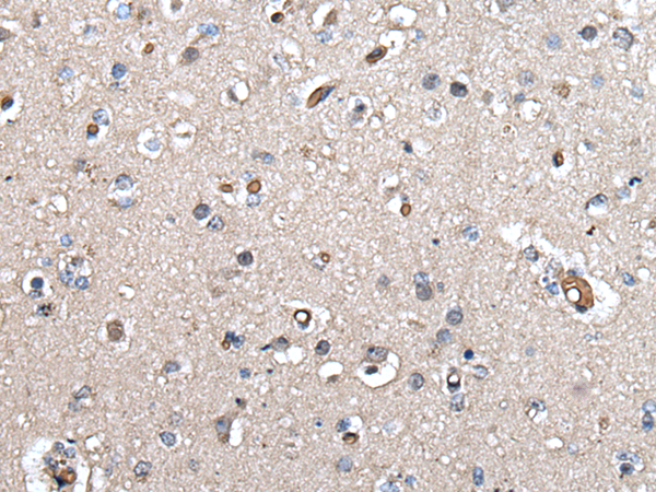 Rabbit Polyclonal Antibody to UMPS