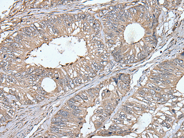 Rabbit Polyclonal Antibody to UNC13B