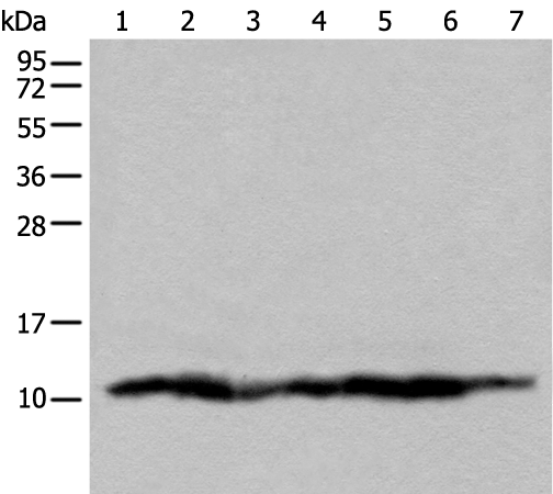 Rabbit Polyclonal Antibody to UQCRQ