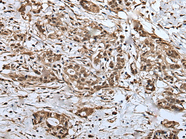Rabbit Polyclonal Antibody to UPK3A