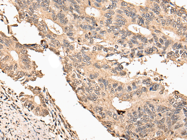 Rabbit Polyclonal Antibody to USP21