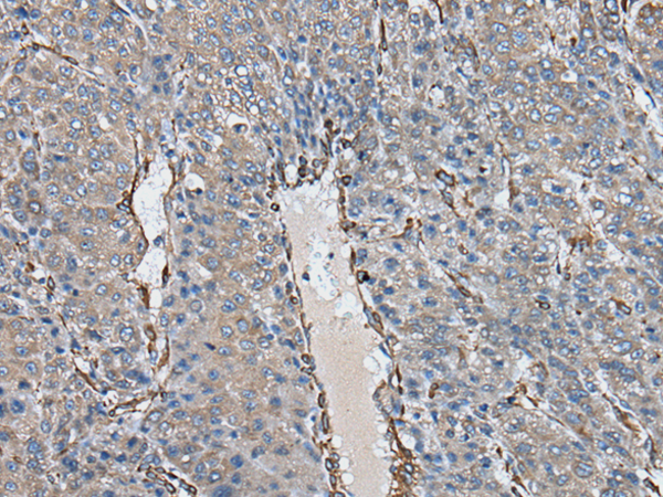 Rabbit Polyclonal Antibody to USP25