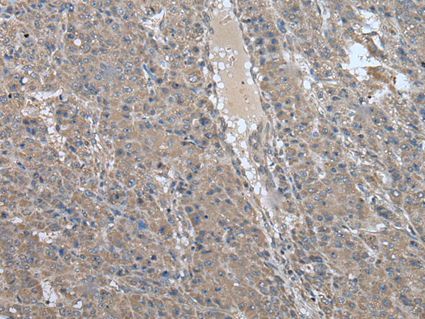 Rabbit Polyclonal Antibody to USP32