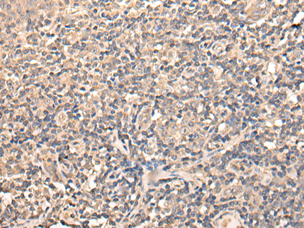 Rabbit Polyclonal Antibody to USP38