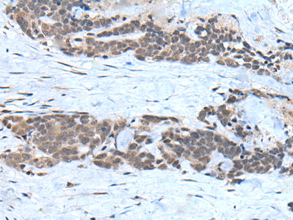 Rabbit Polyclonal Antibody to USP3