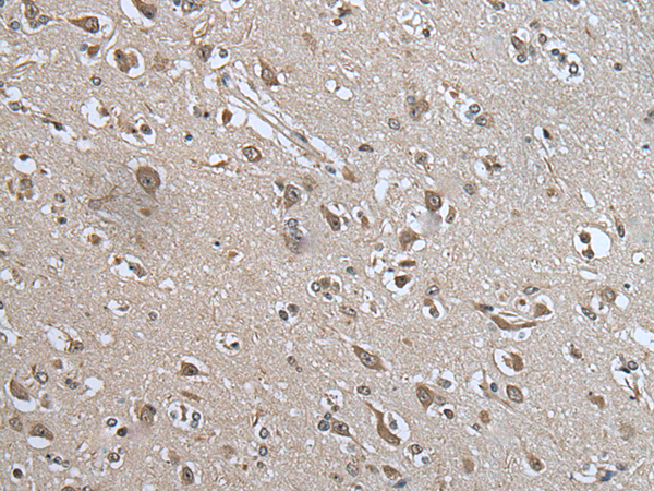 Rabbit Polyclonal Antibody to USP35