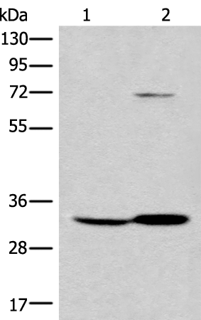 Rabbit Polyclonal Antibody to UTP11