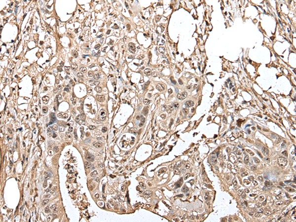 Rabbit Polyclonal Antibody to UTP3