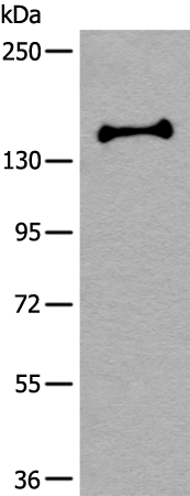 Rabbit Polyclonal Antibody to UTY