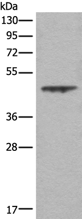 Rabbit Polyclonal Antibody to ASS1