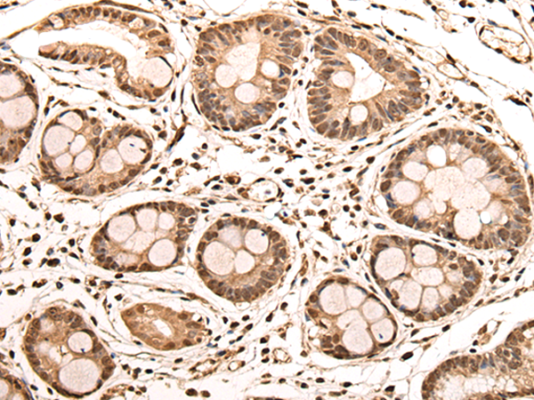 Rabbit Polyclonal Antibody to ASXL2