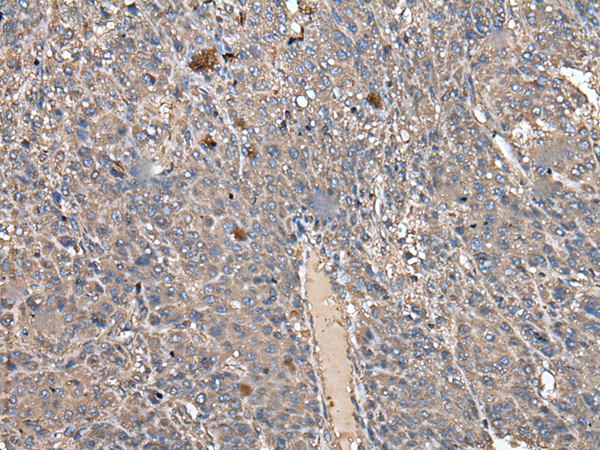 Rabbit Polyclonal Antibody to ATAD1