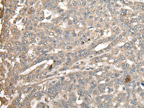 Rabbit Polyclonal Antibody to ATXN3