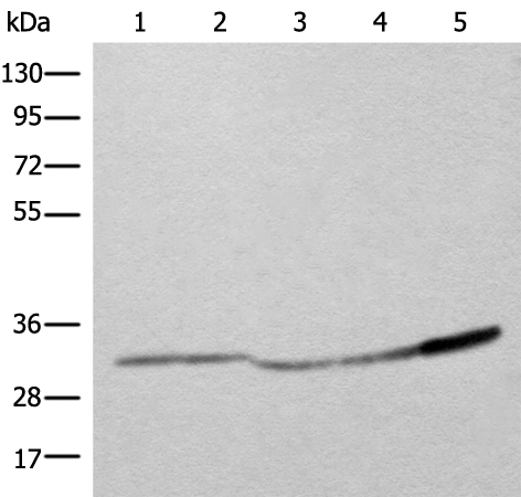 Rabbit Polyclonal Antibody to ATP5F1C