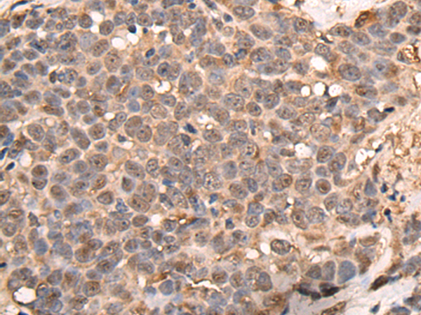 Rabbit Polyclonal Antibody to ATRIP