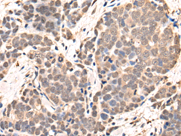 Rabbit Polyclonal Antibody to B3GALNT2