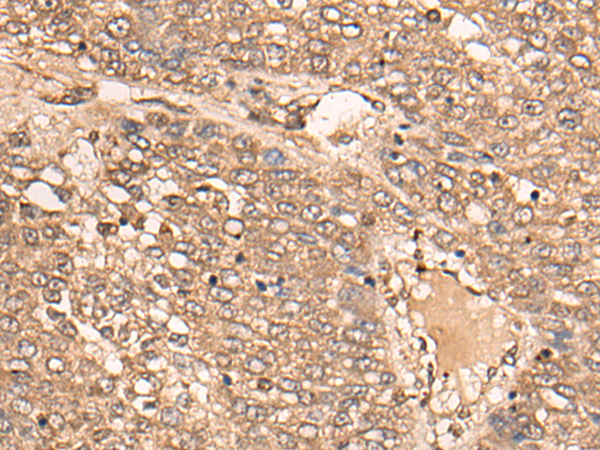 Rabbit Polyclonal Antibody to B4GALNT2