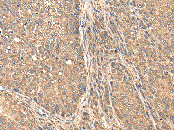 Rabbit Polyclonal Antibody to BAALC