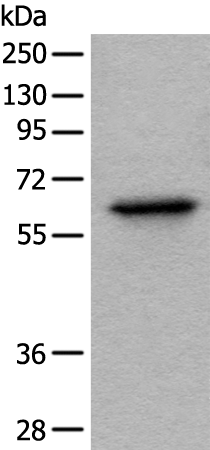 Rabbit Polyclonal Antibody to BAIAP2L1