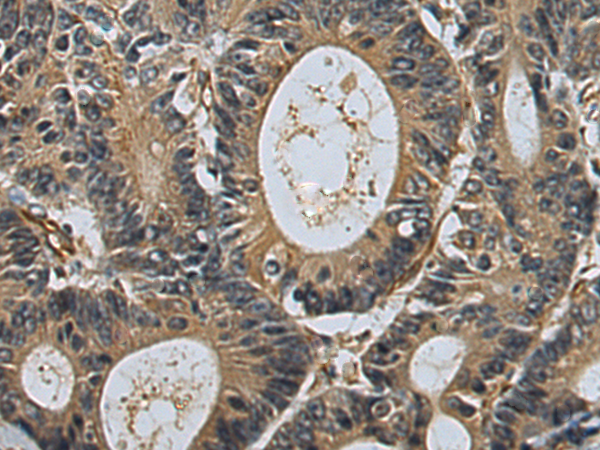Rabbit Polyclonal Antibody to GPANK1