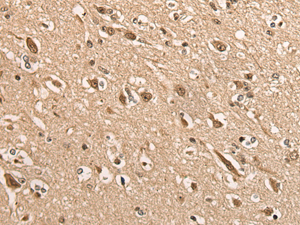 Rabbit Polyclonal Antibody to BATF