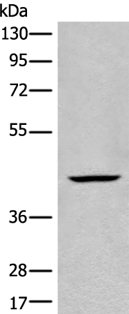 Rabbit Polyclonal Antibody to BBOX1