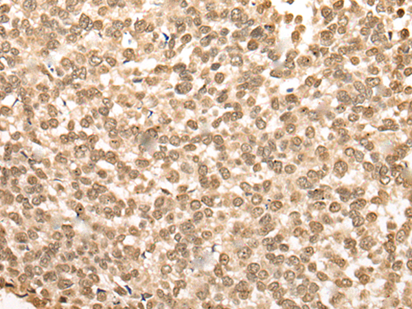 Rabbit Polyclonal Antibody to BBX