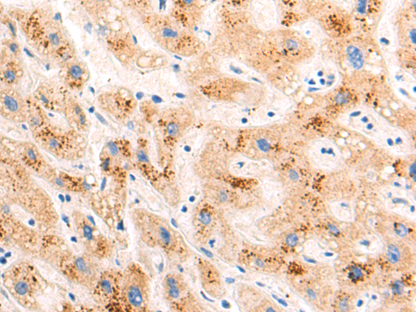 Rabbit Polyclonal Antibody to BCKDK