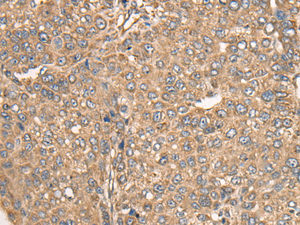 Rabbit Polyclonal Antibody to BCO2