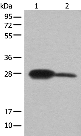 Rabbit Polyclonal Antibody to BDH2
