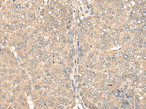 Rabbit Polyclonal Antibody to BEX1