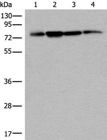 Rabbit Polyclonal Antibody to PHF21A