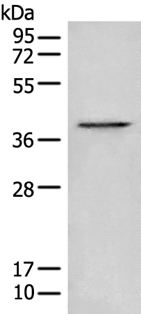Rabbit Polyclonal Antibody to BLVRA