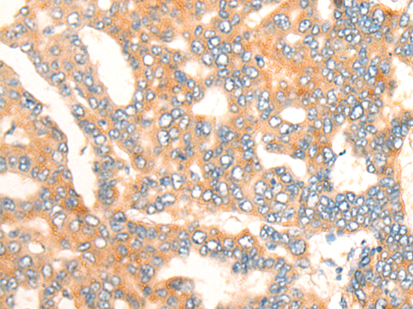 Rabbit Polyclonal Antibody to ZMYND10