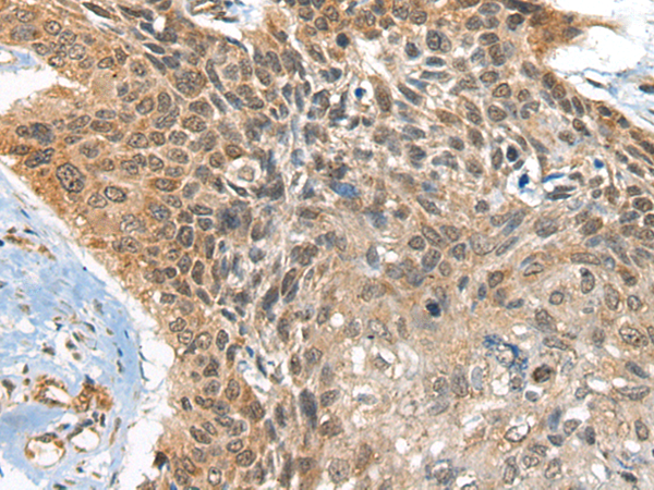Rabbit Polyclonal Antibody to BOLA1
