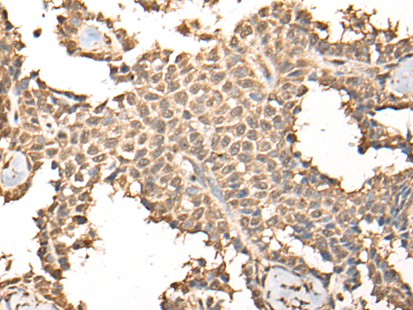 Rabbit Polyclonal Antibody to BRD7