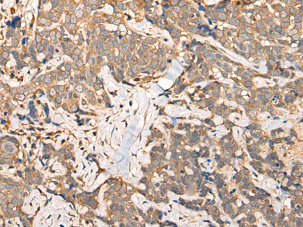 Rabbit Polyclonal Antibody to STAP1