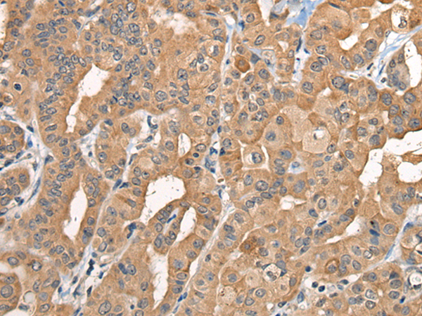 Rabbit Polyclonal Antibody to BCAN